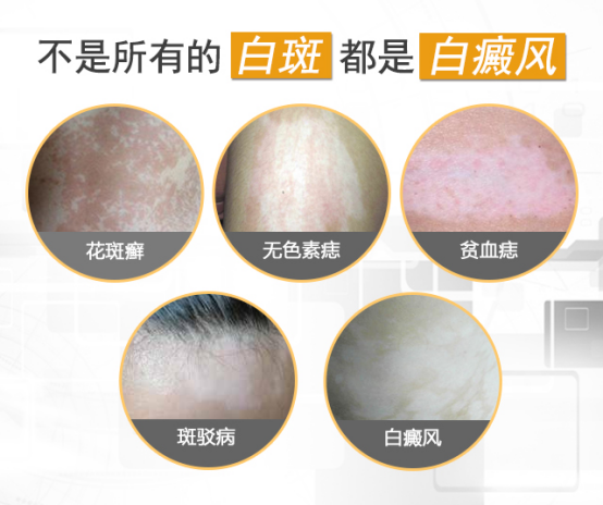 9465f25144d4274217e473c7fcbb21c4.png 图片